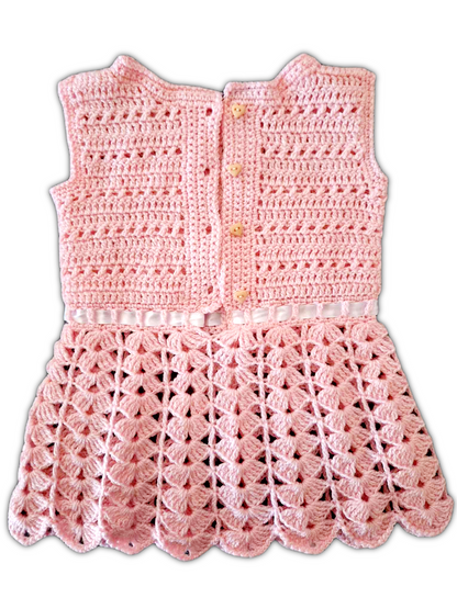 Novamente a parte de trás do vestido com os botões fora das casas.